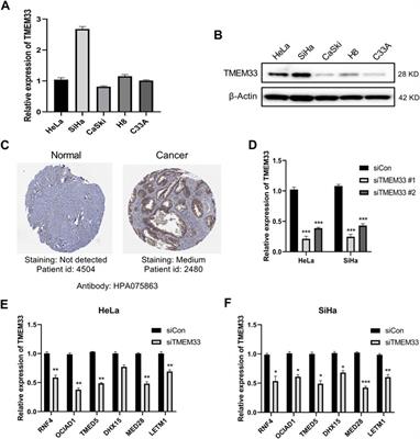 High Expression of TMEM33 Predicts Poor Prognosis and Promotes Cell Proliferation in Cervical Cancer